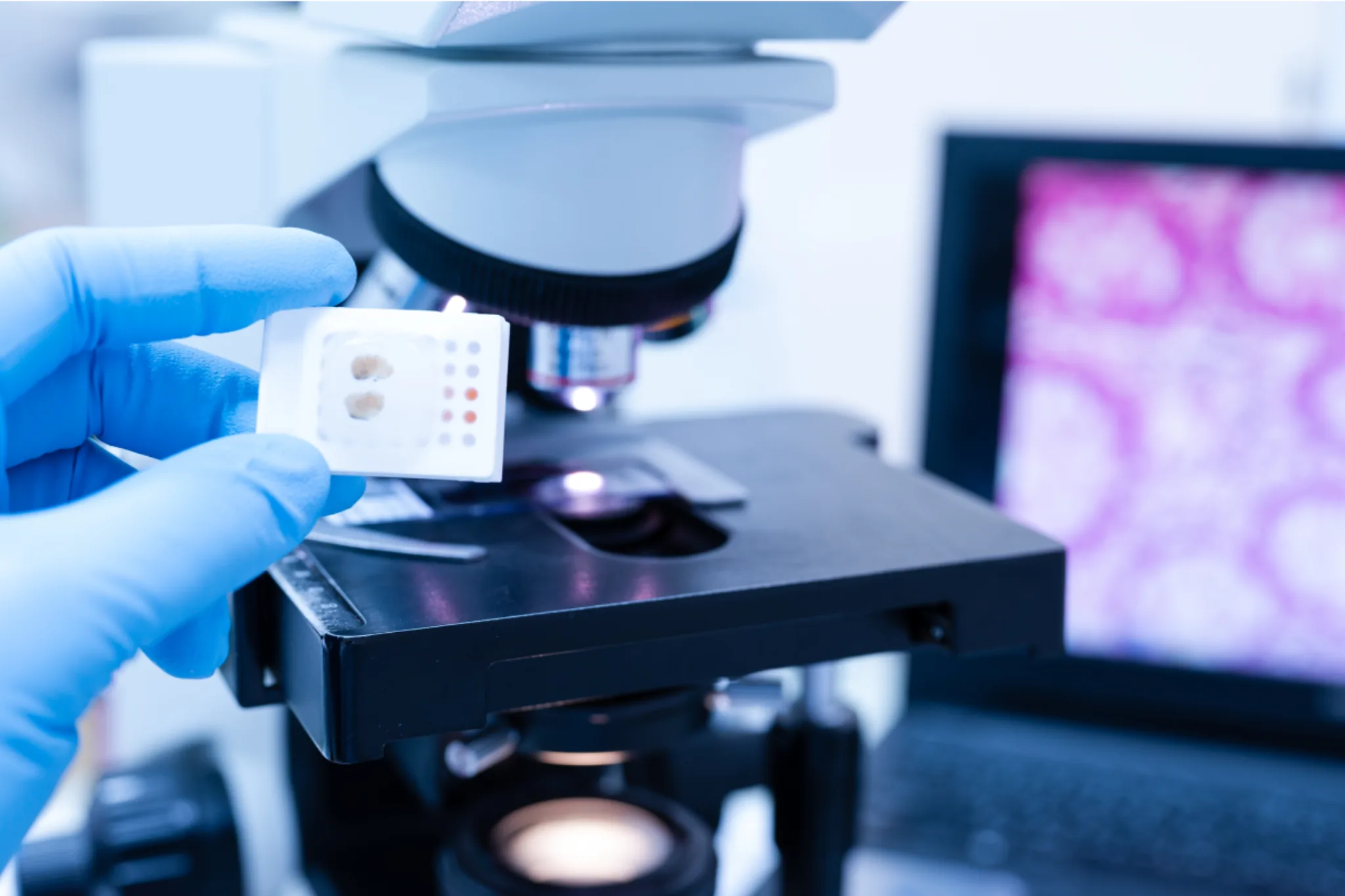 Imunohistochimie în laboratorul Oncodiagnostic Maris Anapat