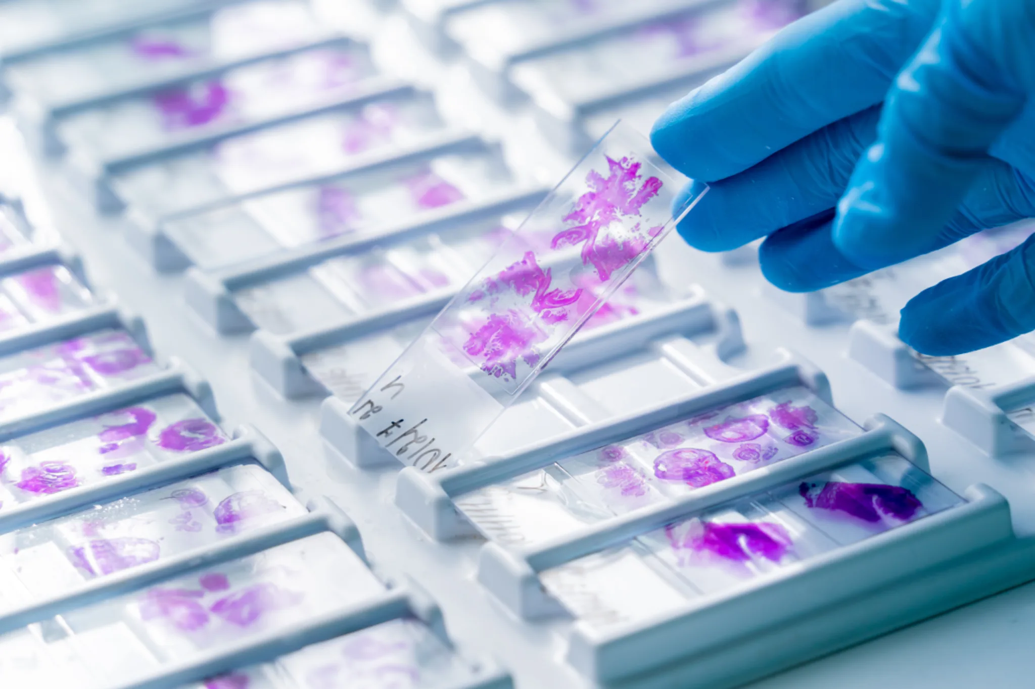 Histopatologie în laboratorul Oncodiagnostic Maris Anapat
